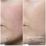 Facial Care Babor Sos Calming for Women product packaging