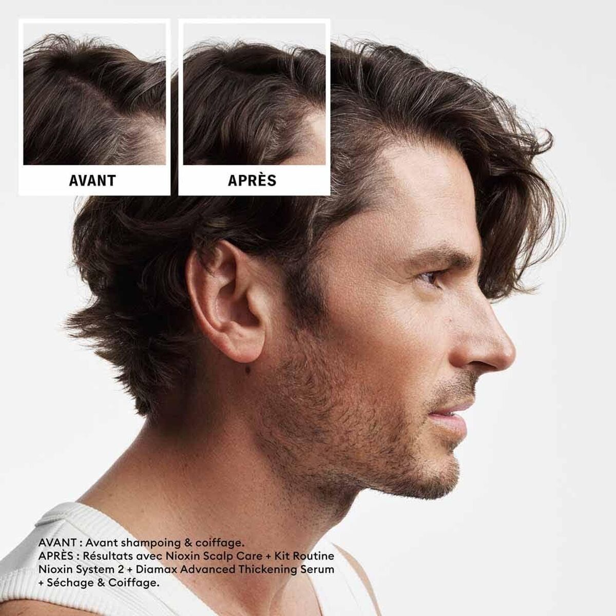 Shampoo and Conditioner Nioxin shampoo bottle