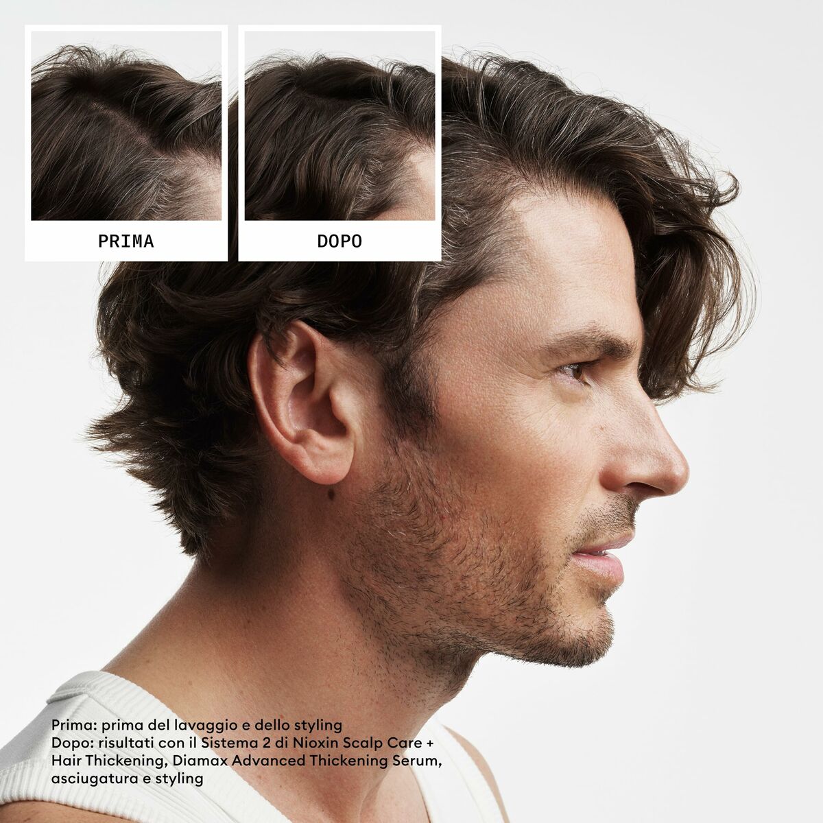 Hair Dressing Set Nioxin 3D CARE SYSTEM product packaging